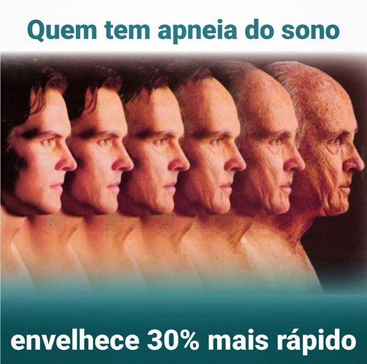 Quem tem apneia do sono envelhece 30% mais rápido!